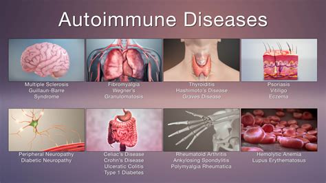 diseases that attack organs.